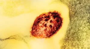 UK lost measles elimination status