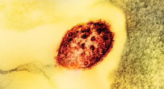 UK lost measles elimination status